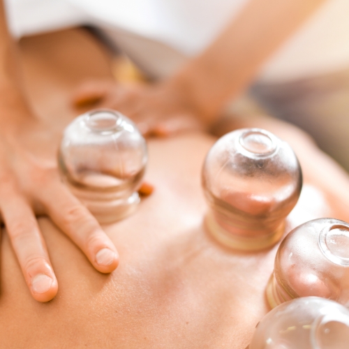 Cupping-OMNI-Physical-Therapy-Uniondale-NY