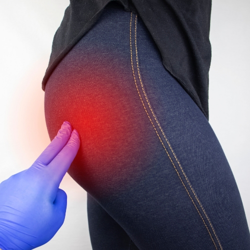 sciatica-pain-relief-OMNI-Physical-Therapy-Uniondale-NY